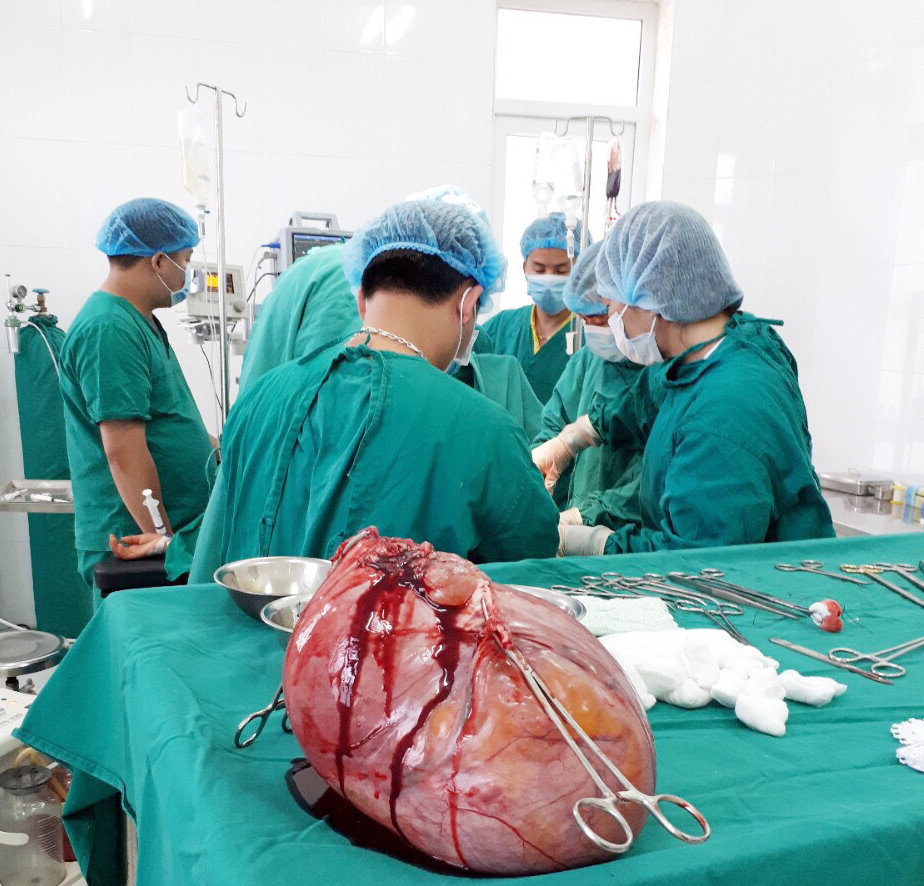 BỆNH VIỆN ĐA KHOA HUYỆN QUẢN BẠ PHẪU THUẬT THÀNH CÔNG  KHỐI U XƠ TỬ CUNG NẶNG 6KG