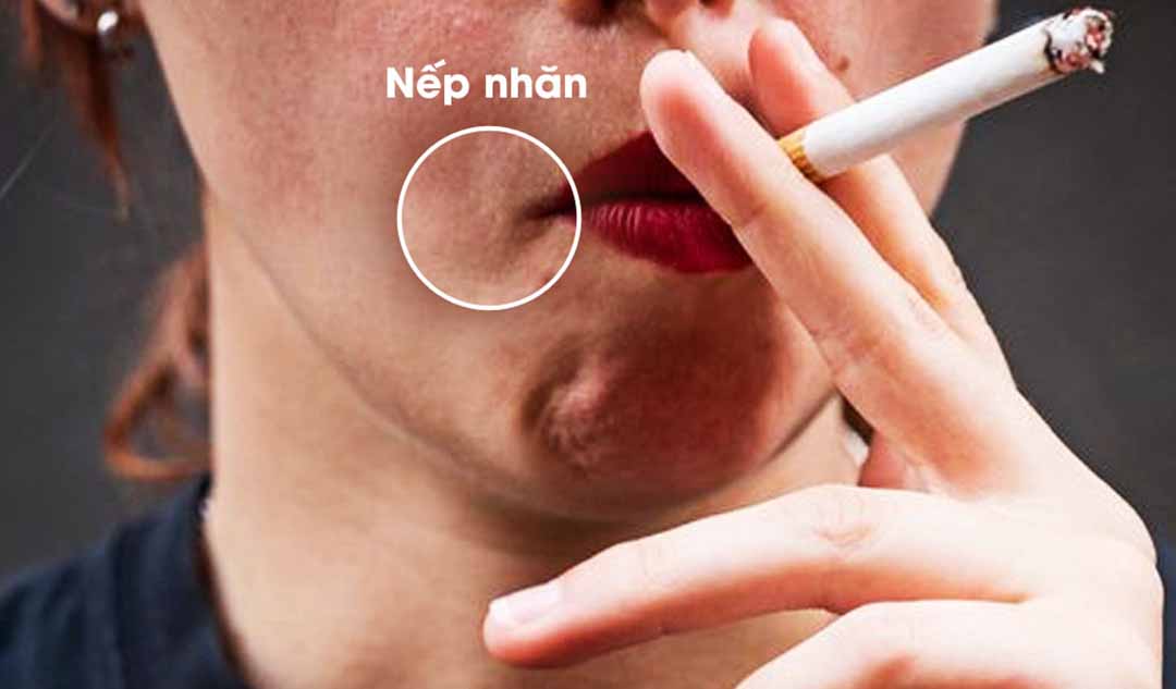 Ảnh hưởng của thuốc lá tới làn da cơ thể người