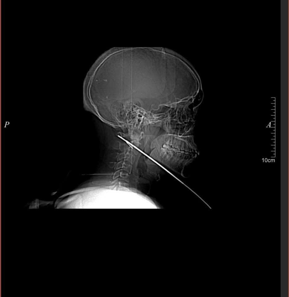 Image Alt